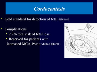 Cordocentesis
• Gold standard for detection of fetal anemia
• Complications
• 2.7% total risk of fetal loss
• Reserved for patients with
increased MCA-PSV or delta OD450
 