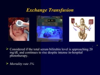 Exchange Transfusion
•.
 Considered if the total serum bilirubin level is approaching 20
mg/dL and continues to rise despite intense in-hospital
phototherapy.
 Mortality rate 1%
 