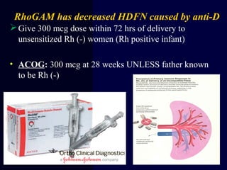 RhoGAM has decreased HDFN caused by anti-D
Give 300 mcg dose within 72 hrs of delivery to
unsensitized Rh (-) women (Rh p...