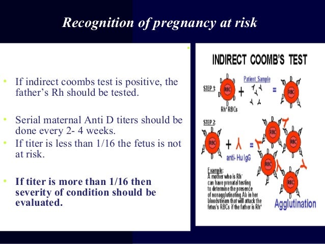 Hydrops fetails for undergranuate