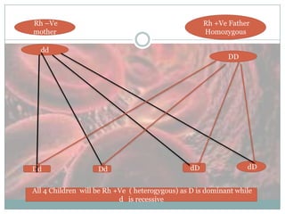 Rh –Ve
mother

Rh +Ve Father
Homozygous

dd

Dd

DD

Dd

dD

dD

All 4 Children will be Rh +Ve ( heterogygous) as D is dominant while
d is recessive

 