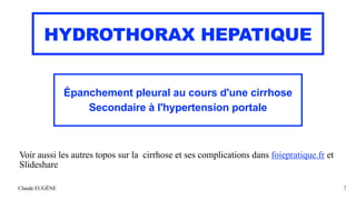 Claude EUGÈNE
HYDROTHORAX HEPATIQUE
Épanchement pleural au cours d'une cirrhose


Secondaire à l'hypertension portale
1
Vo...