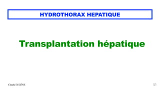 Claude EUGÈNE
HYDROTHORAX HEPATIQUE
Transplantation hépatique


51
 