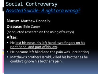 Social Controversy Assisted Suicide:  A right or a wrong?Name:  Matthew Donnelly Disease: Skin Caner (conducted research on the using of x-rays)After: He lost his nose, his left hand, two fingers on his right hand, and part of his jaw. He became left blind and the pain was unrelenting. Matthew's brother Harold, killed his brotheras he couldn’t ignore his brother’s pain.