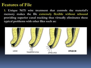 Features of File
1. Unique NiTi wire treatment that controls the material’s
memory makes the file extremely flexible without rebound
providing superior canal tracking thus virtually eliminates these
typical problems with other files such as:
 
