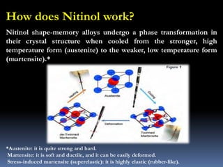 Nitinol shape-memory alloys undergo a phase transformation in
their crystal structure when cooled from the stronger, high
temperature form (austenite) to the weaker, low temperature form
(martensite).*
How does Nitinol work?
*Austenite: it is quite strong and hard.
Martensite: it is soft and ductile, and it can be easily deformed.
Stress-induced martensite (superelastic): it is highly elastic (rubber-like).
 