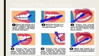 PROCEDURE STEPS- for conscious
 