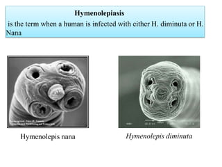 Hymenolepis Nana pptx hymenolepis-nana-pptx