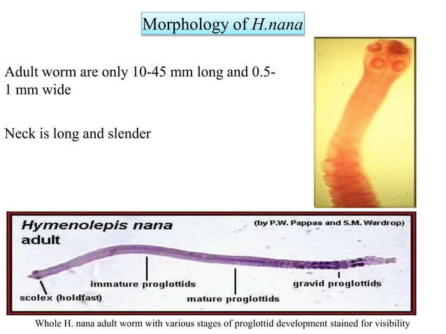 Hymenolepis Nana pptx hymenolepis-nana-pptx
