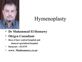 Hymenoplasty
• Dr Muhammad El Hennawy
• Ob/gyn Consultant
• Rass el barr central hospital and
dumyat specialised hospital
• Dumyatt – EGYPT
• www. Mmhennawy.co.nr
 