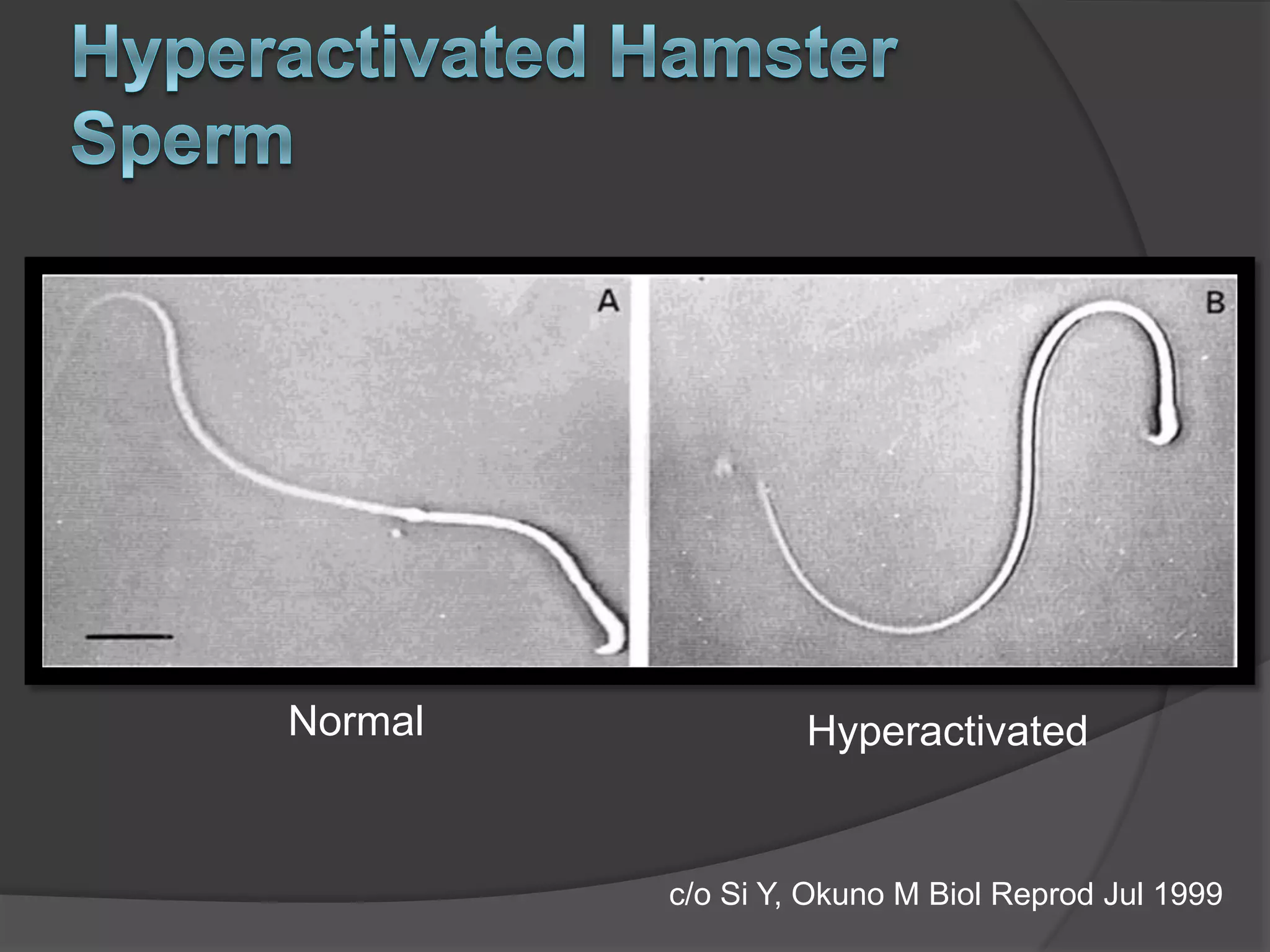 Hyperactivation Hyperactivation | PPTX