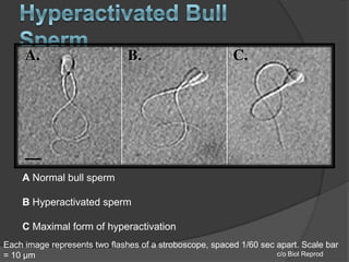 Hyperactivation Hyperactivation | PPTX
