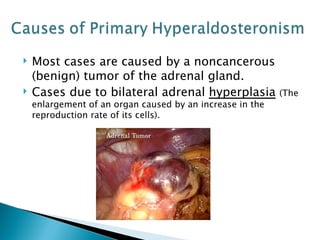 Most cases are caused by a noncancerous (benign) tumor of the adrenal gland. Cases due to bilateral adrenal  hyperplasia   (The enlargement of an organ caused by an increase in the reproduction rate of its cells). 
