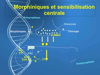Morphiniques et sensibilisation
centrale
Morphiniques
- +
Présynaptique
Glutamate
Chirurgie
+
R !
R NMDA
Ca2+
+
PKC
NOS
COX 2
NO
PG
+
+
+
 