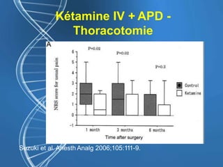 Kétamine IV + APD -
Thoracotomie
Suzuki et al. Anesth Analg 2006;105:111-9.
 