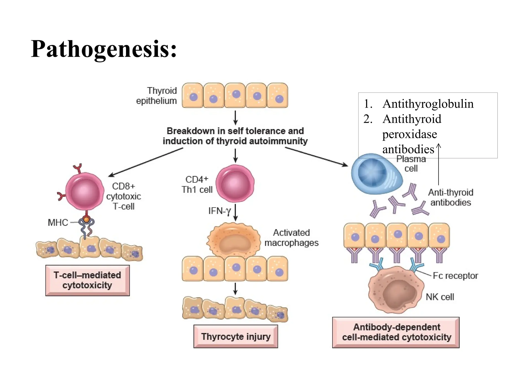 Pathogenesis:
1. Antithyroglobulin
2. Antithyroid
peroxidase
antibodies
 
