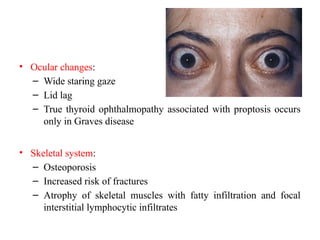 • Ocular changes:
– Wide staring gaze
– Lid lag
– True thyroid ophthalmopathy associated with proptosis occurs
only in Graves disease
• Skeletal system:
– Osteoporosis
– Increased risk of fractures
– Atrophy of skeletal muscles with fatty infiltration and focal
interstitial lymphocytic infiltrates
 