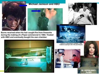 Burns received when his hair caught fire from fireworks
during the making of a Pepsi commercial in 1984. Treated
with HBO and eventually bought his own chamber.
Michael Jackson and HBO
 