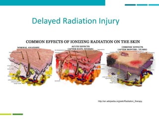 34
http://en.wikipedia.org/wiki/Radiation_therapy
Delayed Radiation Injury
 