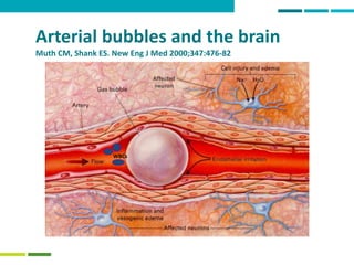 47
Arterial bubbles and the brain
Muth CM, Shank ES. New Eng J Med 2000;347:476-82
WBCs
 