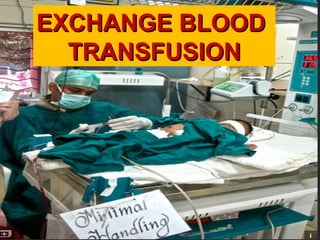EXCHANGE BLOODEXCHANGE BLOOD
TRANSFUSIONTRANSFUSION
 