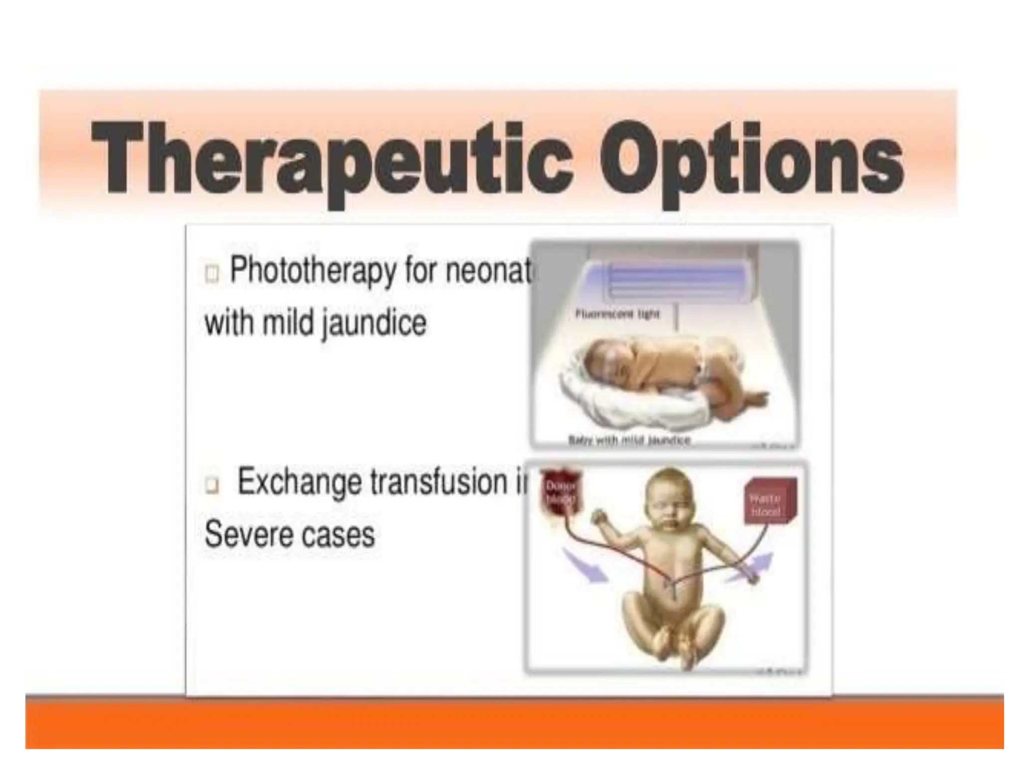 HYPERBILIRUBINEMIA.pptx in children and newborn PPTX