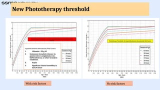 Hyperbilirubinemia in neonates presentation | PPTX