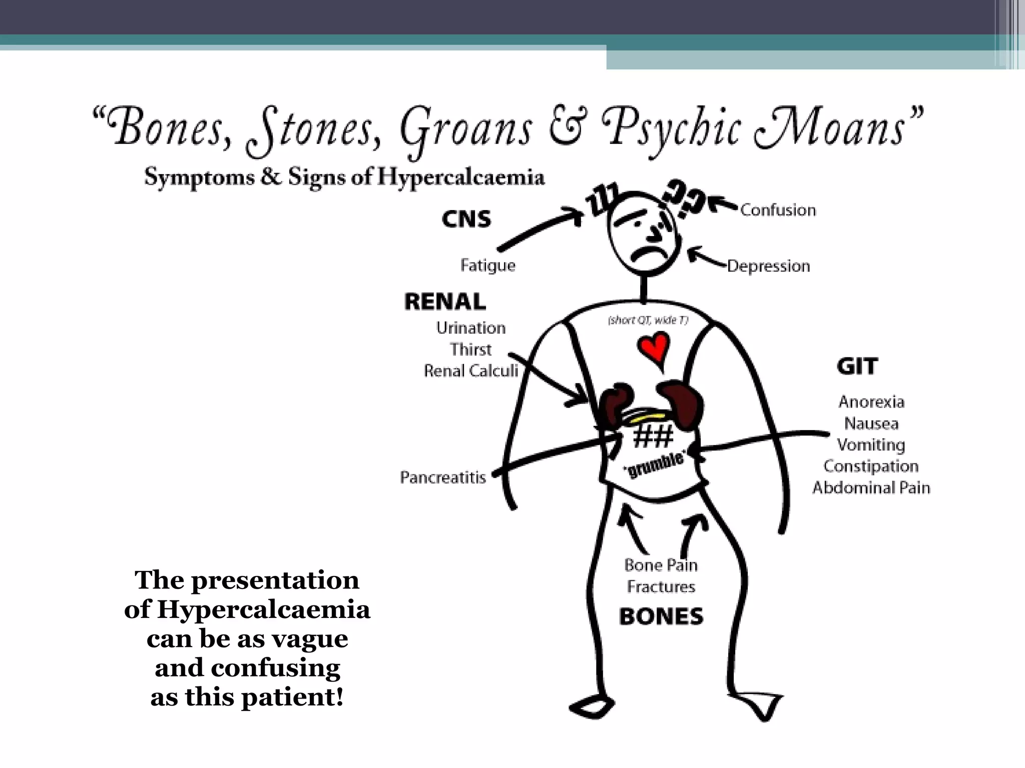 The presentation of Hypercalcaemia can be as vague and confusing as this patient! 