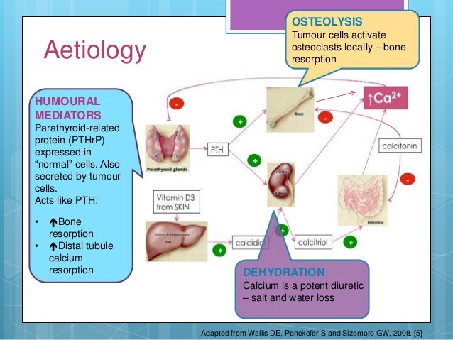 Hypercalcaemia in Malignancy