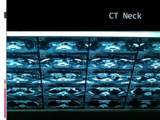 CT Neck
 