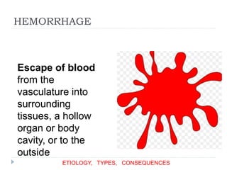HEMORRHAGE
Escape of blood
from the
vasculature into
surrounding
tissues, a hollow
organ or body
cavity, or to the
outside
ETIOLOGY, TYPES, CONSEQUENCES
 