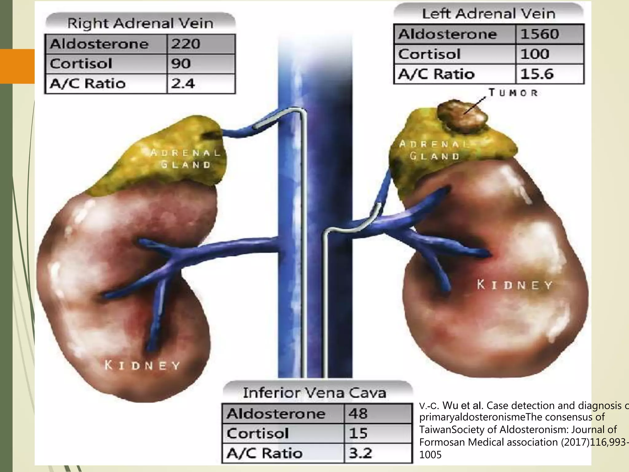 V.-C. Wu et al. Case detection and diagnosis o
primaryaldosteronismeThe consensus of
TaiwanSociety of Aldosteronism: Journal of
Formosan Medical association (2017)116,993-
1005
 