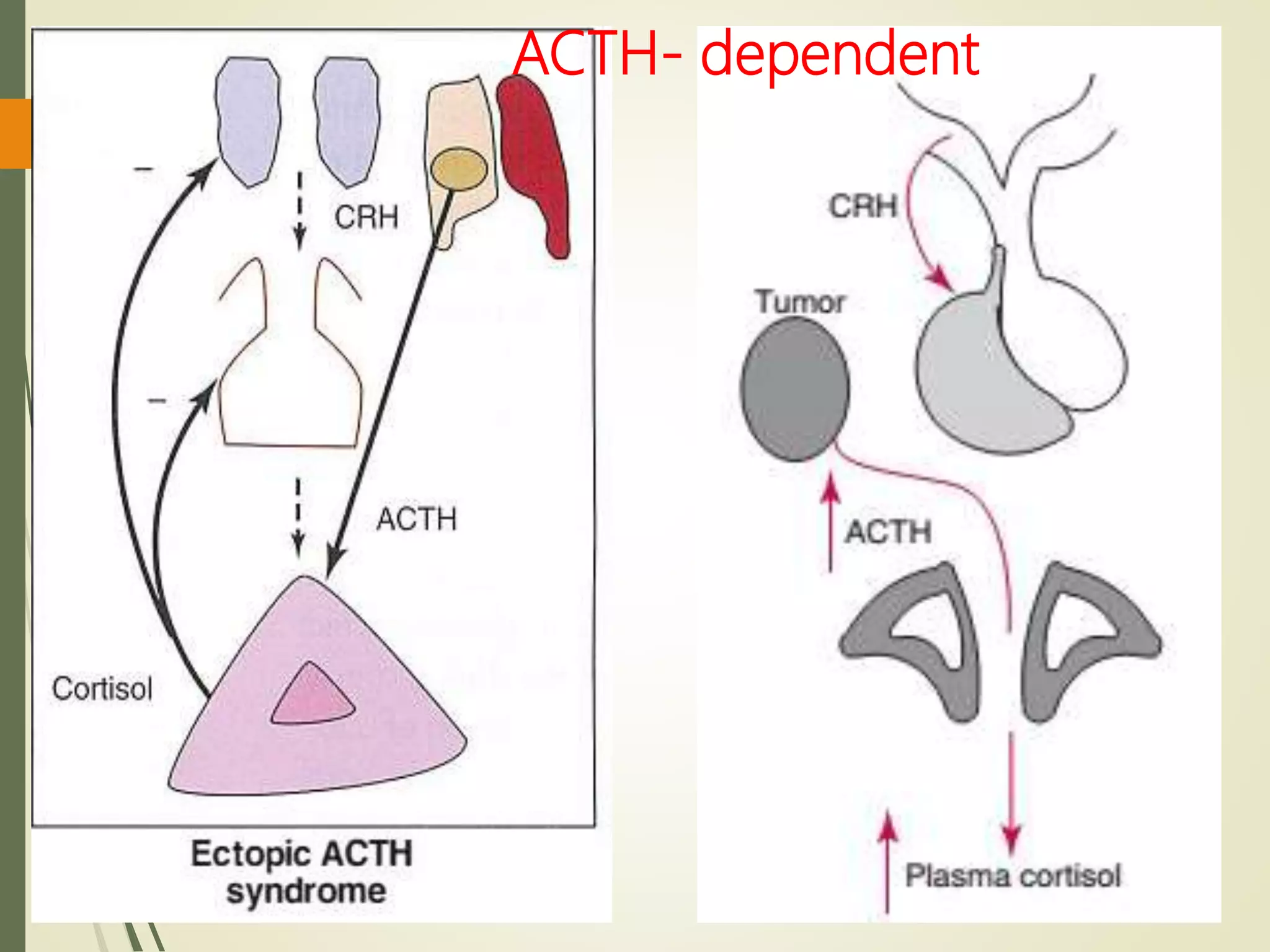 ACTH- dependent
 