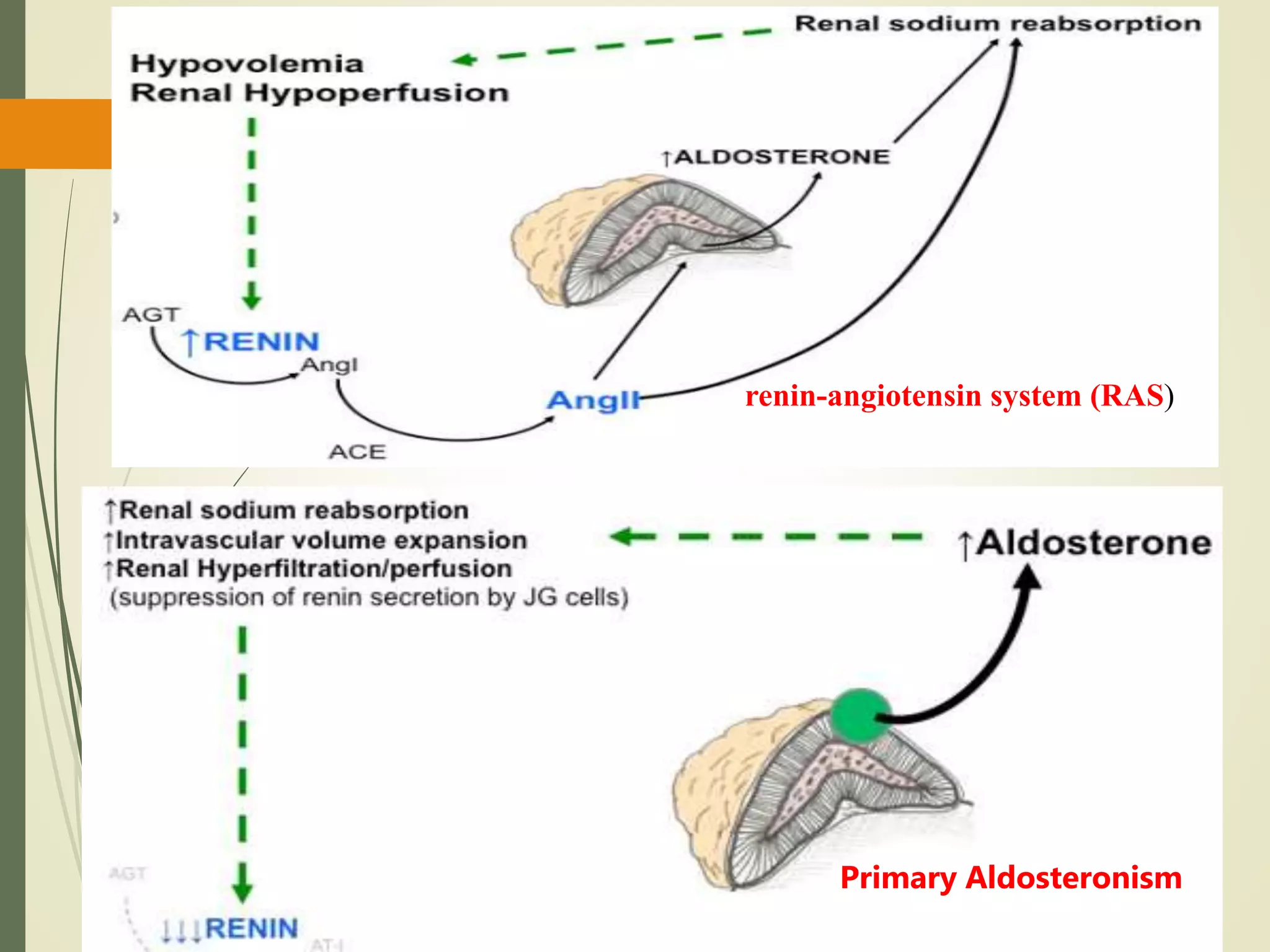 renin-angiotensin system (RAS)
Primary Aldosteronism
 