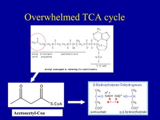 Overwhelmed TCA cycle
Acetoacetyl-Coa
 