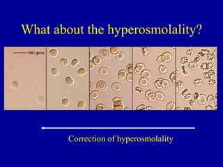 Correction of hyperosmolality
What about the hyperosmolality?
 