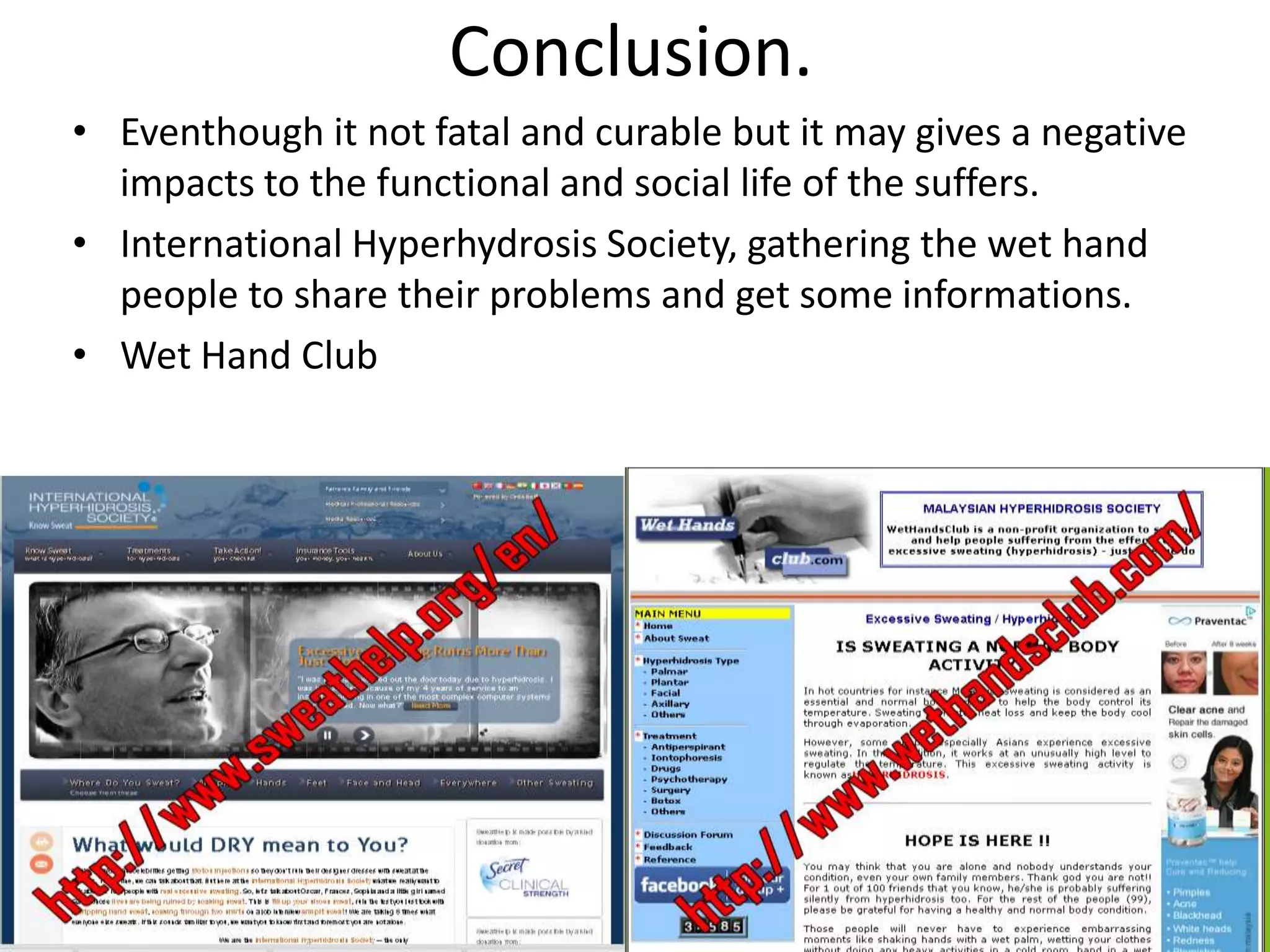 Conclusion.
• Eventhough it not fatal and curable but it may gives a negative
impacts to the functional and social life of the suffers.
• International Hyperhydrosis Society, gathering the wet hand
people to share their problems and get some informations.
• Wet Hand Club

 