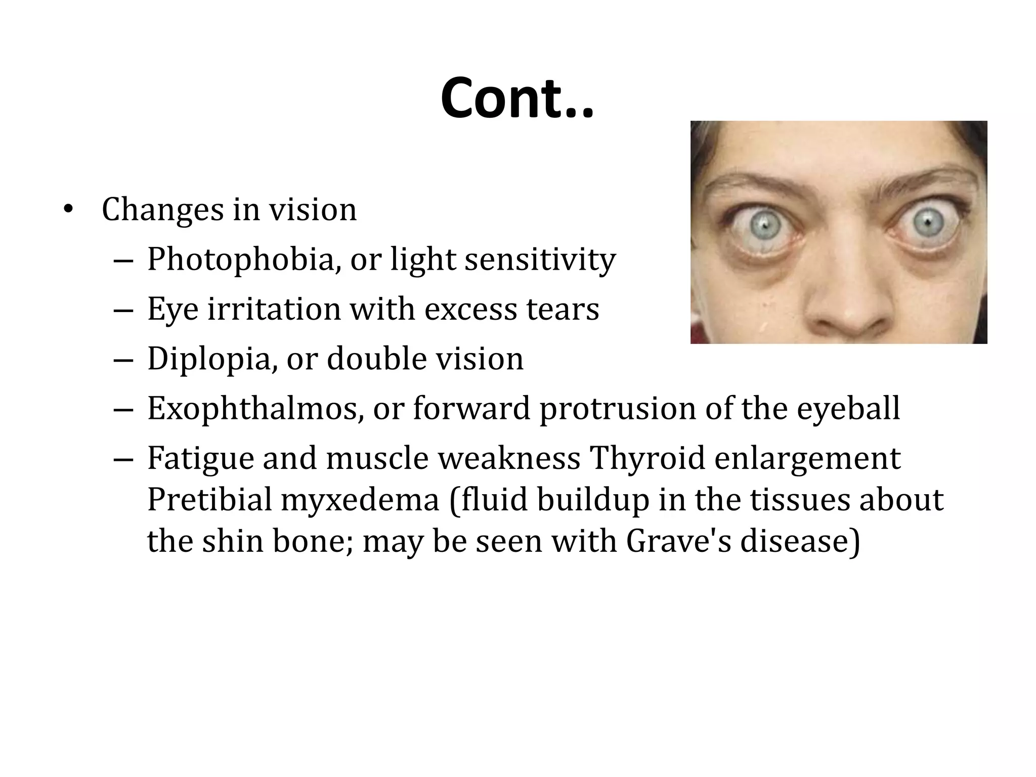 Cont..
• Changes in vision
– Photophobia, or light sensitivity
– Eye irritation with excess tears
– Diplopia, or double vision
– Exophthalmos, or forward protrusion of the eyeball
– Fatigue and muscle weakness Thyroid enlargement
Pretibial myxedema (fluid buildup in the tissues about
the shin bone; may be seen with Grave's disease)
 