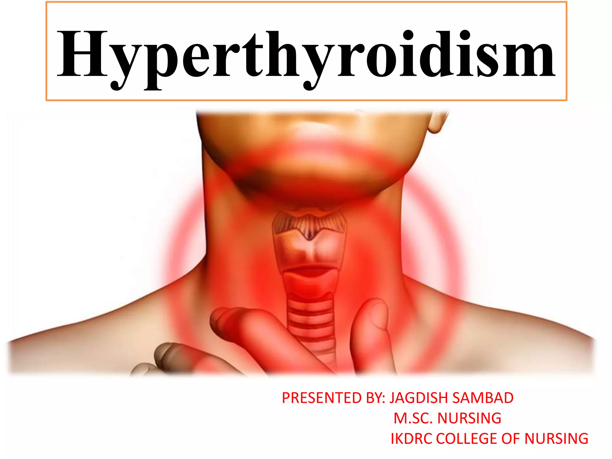 Hyperthyroidism
PRESENTED BY: JAGDISH SAMBAD
M.SC. NURSING
IKDRC COLLEGE OF NURSING
 