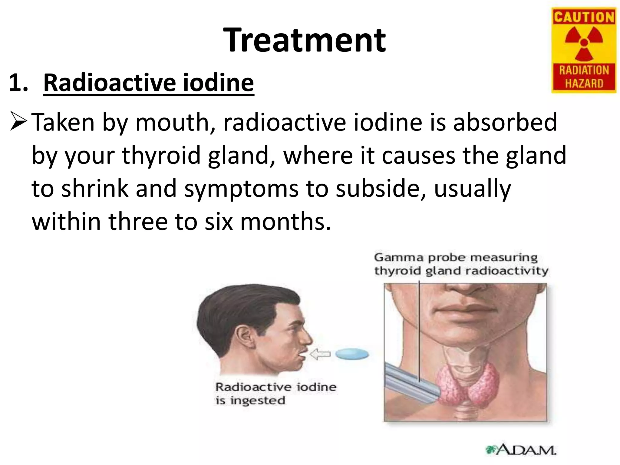 Treatment
1. Radioactive iodine
Taken by mouth, radioactive iodine is absorbed
by your thyroid gland, where it causes the gland
to shrink and symptoms to subside, usually
within three to six months.
 
