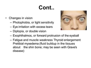 Cont..
• Changes in vision
– Photophobia, or light sensitivity
– Eye irritation with excess tears
– Diplopia, or double vision
– Exophthalmos, or forward protrusion of the eyeball
– Fatigue and muscle weakness Thyroid enlargement
Pretibial myxedema (fluid buildup in the tissues
about the shin bone; may be seen with Grave's
disease)
 