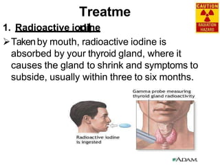 Treatme
nt
1. Radioactive iodine
Takenby mouth, radioactive iodine is
absorbed by your thyroid gland, where it
causes the gland to shrink and symptoms to
subside, usually within three to six months.
 
