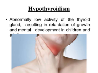 Hypothyroidism
• Abnormally low activity of the thyroid
gland, resulting in retardation of growth
and mental development in children and
adults.
 