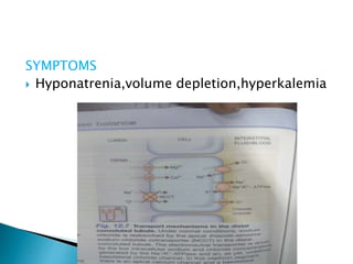 SYMPTOMS
 Hyponatrenia,volume depletion,hyperkalemia
 