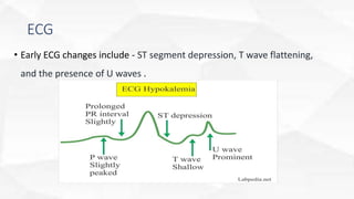 ECG
• Early ECG changes include - ST segment depression, T wave flattening,
and the presence of U waves .
 