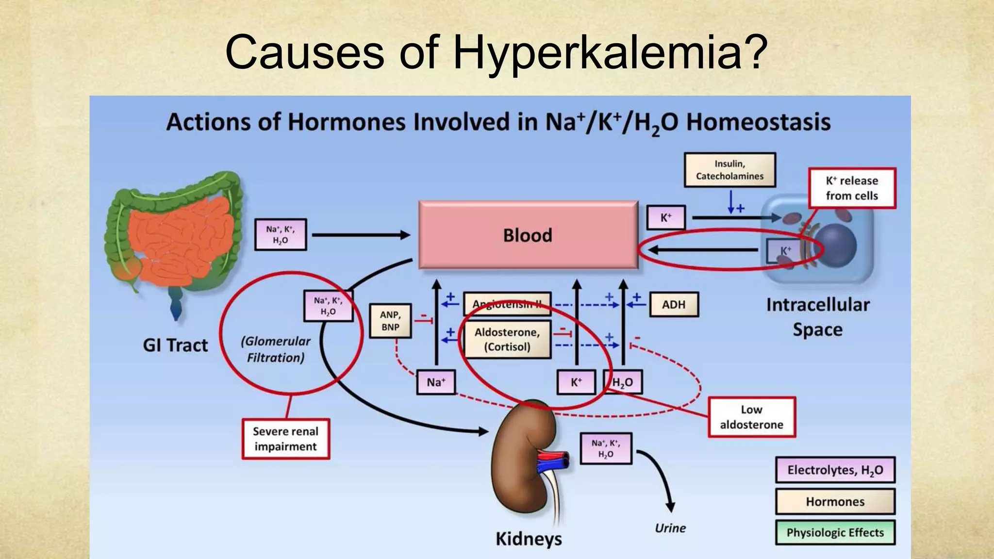 Hyperkalemia pathophysiology and treatment | PPTX