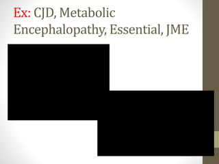 Ex: CJD, Metabolic
Encephalopathy, Essential, JME
 