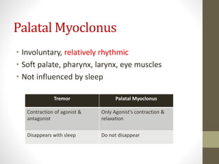 Palatal Myoclonus
• Involuntary, relatively rhythmic
• Soft palate, pharynx, larynx, eye muscles
• Not influenced by sleep
Tremor Palatal Myoclonus
Contraction of agonist &
antagonist
Only Agonist’s contraction &
relaxation
Disappears with sleep Do not disappear
 
