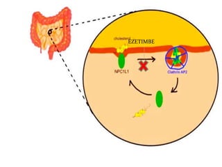 EZETIMBE
 