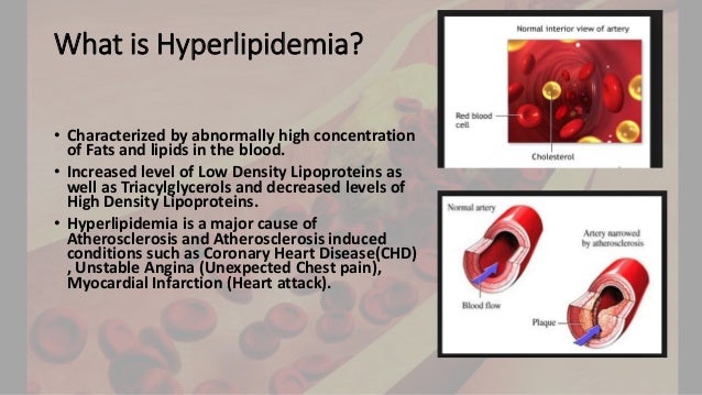  Hyperlipidemia pharmacotherapy